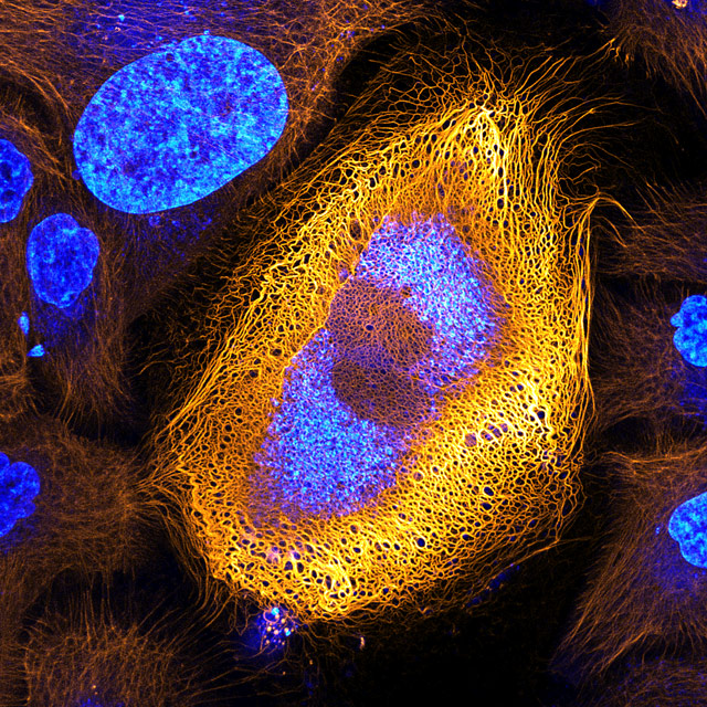 Immortalized human skin cells (HaCaT keratinocytes) expressing fluorescently tagged keratin, © Dr. Bram van den Broek, Andriy Volkov, Dr. Kees Jalink, Dr. Reinhard Windoffer & Dr. Nicole Schwarz, The Netherlands Cancer Institute, BioImaging Facility & Department of Cell Biology, Amsterdam, The Netherlands, 1ST PLACE, Nikon’s Small World — Photomicrography Competition