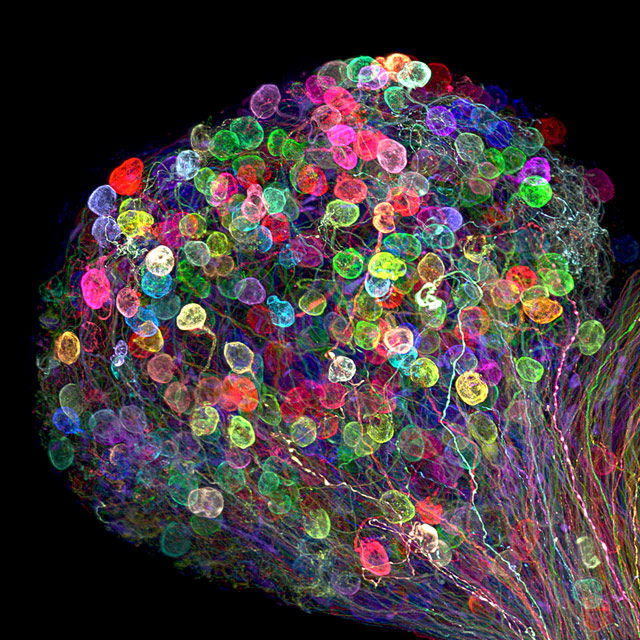 Individually labeled axons in an embryonic chick ciliary ganglion, © Dr. Ryo Egawa, Nagoya University, Graduate School of Medicine, Nagoya, Japan, 7TH PLACE, Nikon’s Small World — Photomicrography Competition