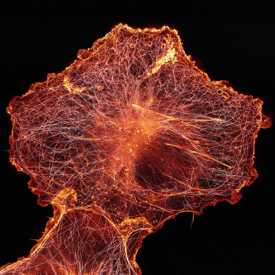 African green monkey cell (COS-7) stained for actin and microtubules, © Andrew Moore, © Dr. Erika Holzbaur, University of Pennsylvania, Department of Physiology, Philadelphia, Pennsylvania, USA, 14th Place, Nikon’s Small World - Photomicrography Competition