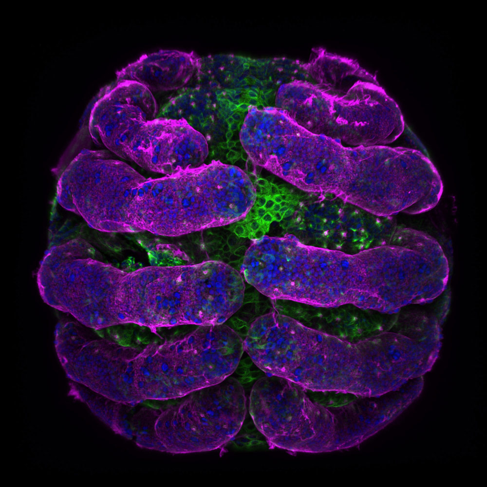 Parasteatoda tepidariorum (spider embryo) stained for embryo surface (pink), nuclei (blue) and microtubules (green), © Dr. Tessa Montague, Harvard University, Department of Molecular and Cellular Biology, Cambridge, Massachusetts, USA, 5th Place, Nikon’s Small World - Photomicrography Competition